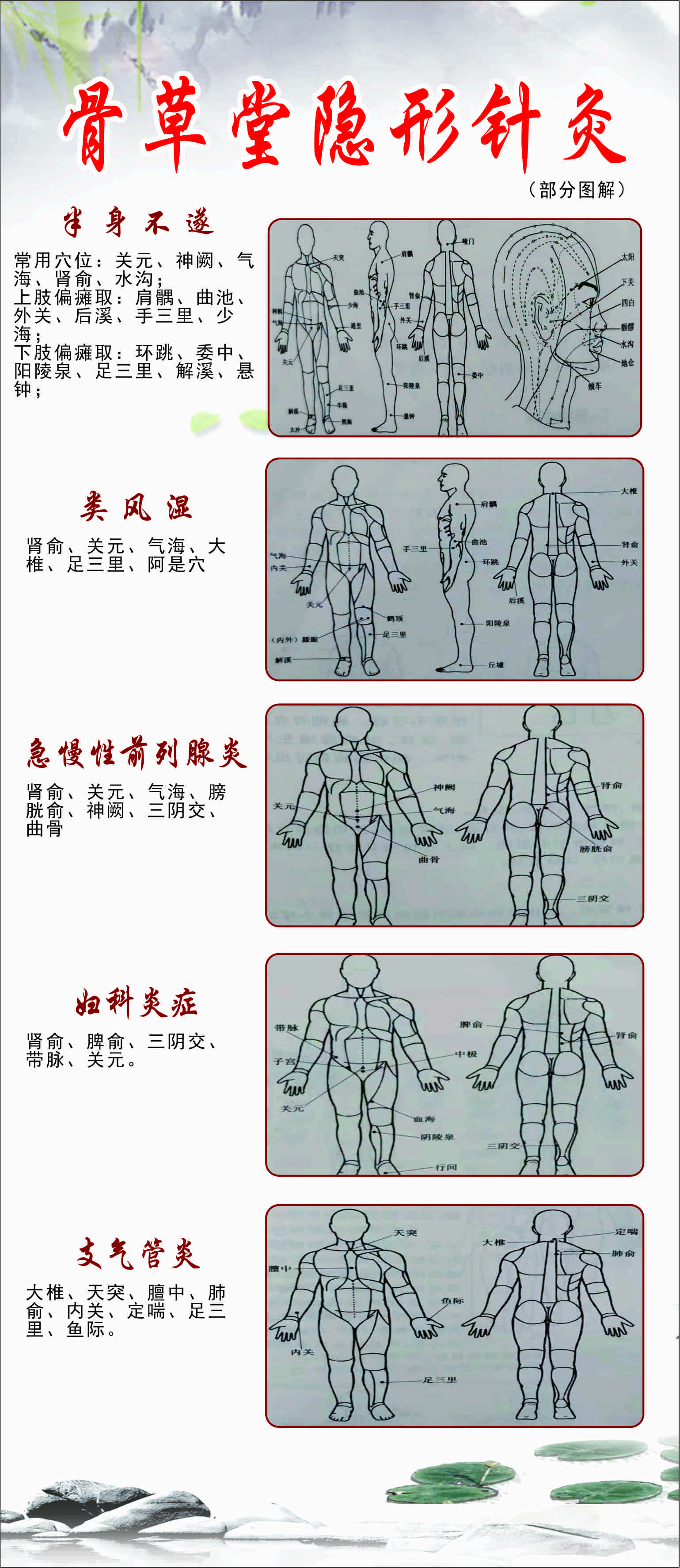 骨草堂隱形針灸