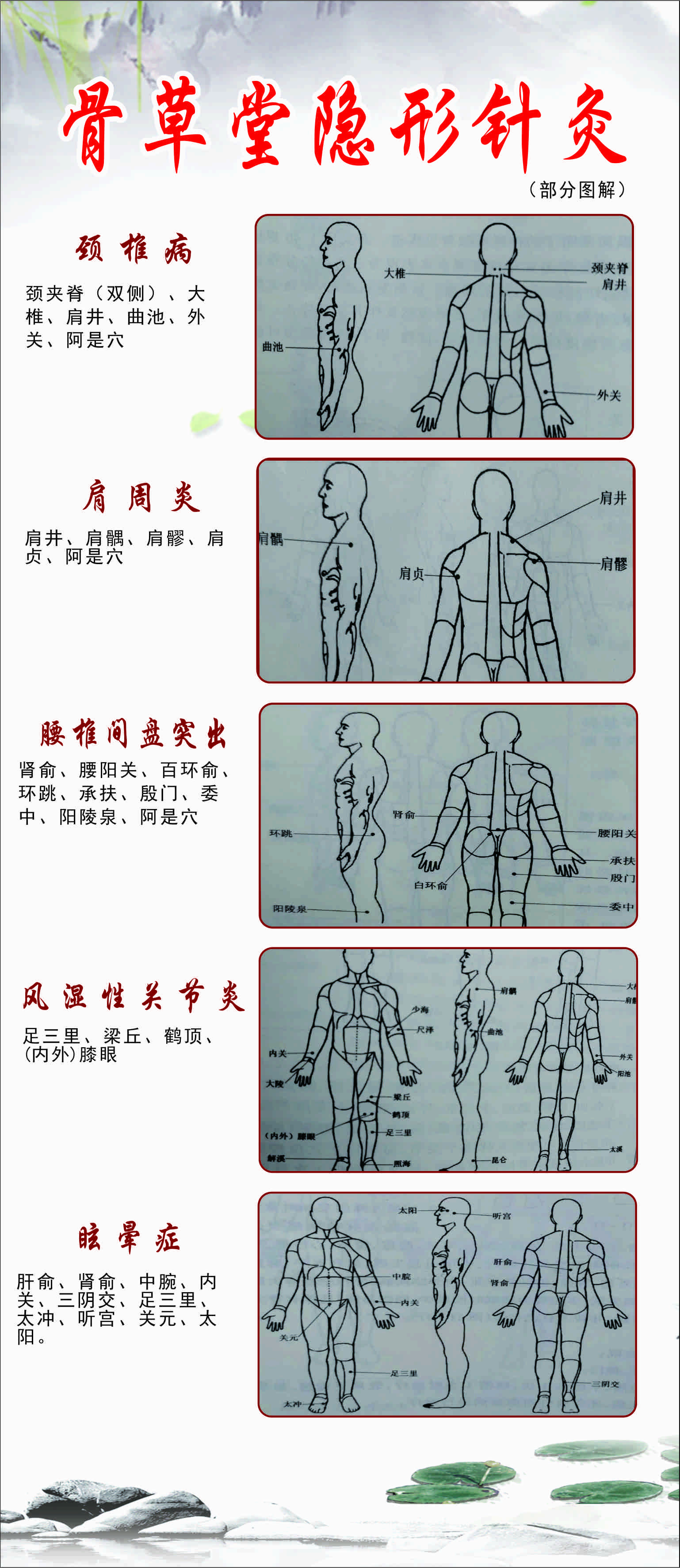 骨草堂隱形針灸